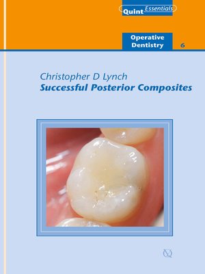 cover image of Successful Posterior Composites